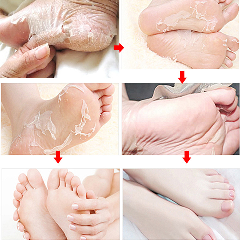 Peeling Peeling Foot Mask – Image 6